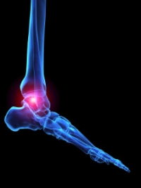 Different Types of Arthritis in the Feet