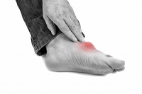 How to Prevent Gout