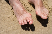 The Causes of Hammertoe